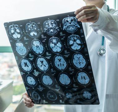 Doctor holding a sheet of brain scans