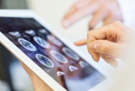 Doctors looking at a brain scan on an ipad