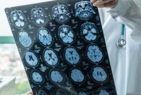 Doctor holding a sheet of brain scans