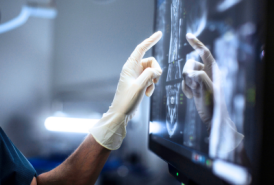 Doctor wearing gloves examines a radiology scan on a touchscreen monitor in an operating room.
