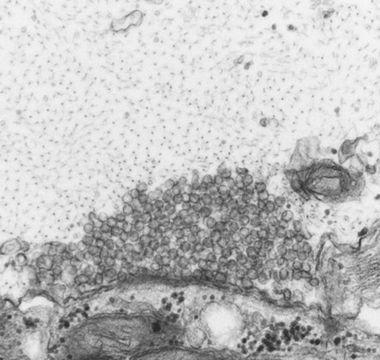 Electron microscope image of a sea lamprey synapse