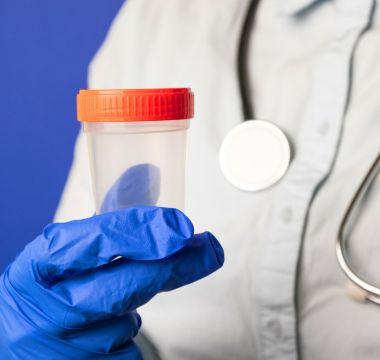 Doctor holding a stool sample container