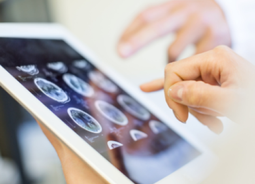 Doctors looking at a brain scan on an ipad