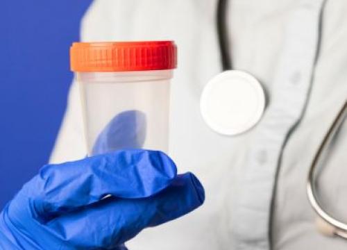 Doctor holding a stool sample container
