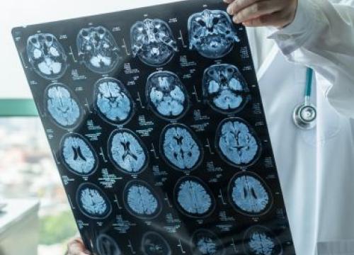 Doctor holding a sheet of brain scans