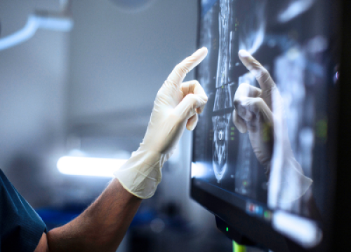 Doctor wearing gloves examines a radiology scan on a touchscreen monitor in an operating room.