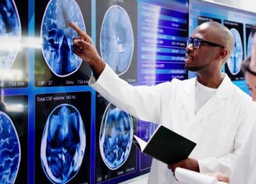 Researcher looking at brain scan